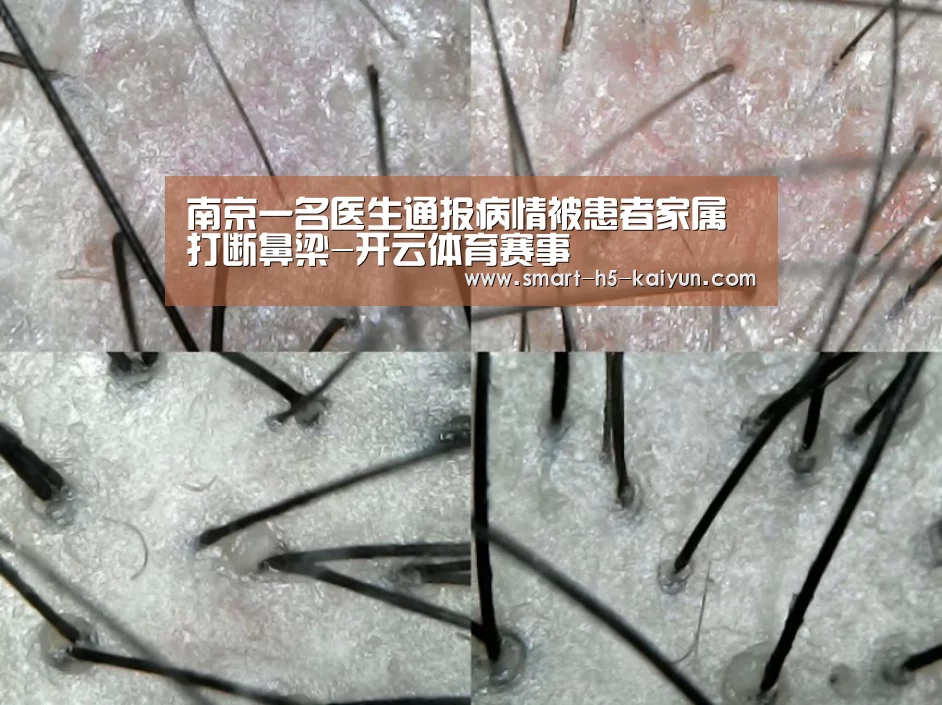 南京一名医生通报病情被患者家属打断鼻梁-开云体育赛事